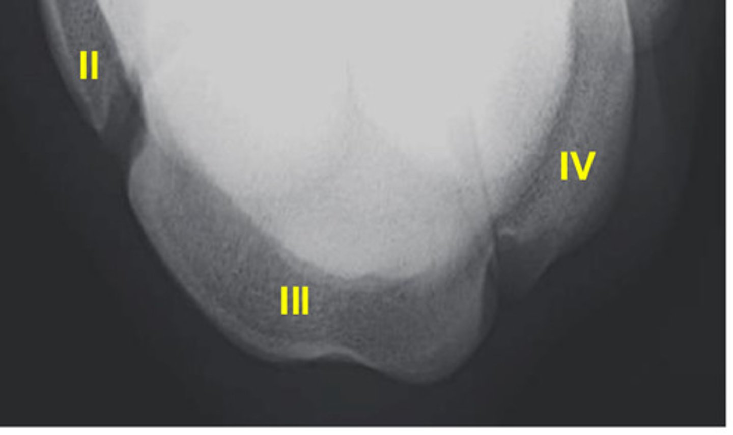 <p>What is number II?</p>