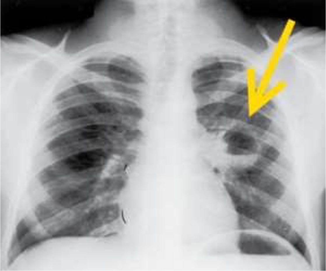 <p>what does this xray show?</p>