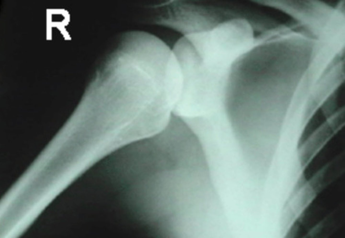 <p>What is the name of the radiographic projection seen here?</p>