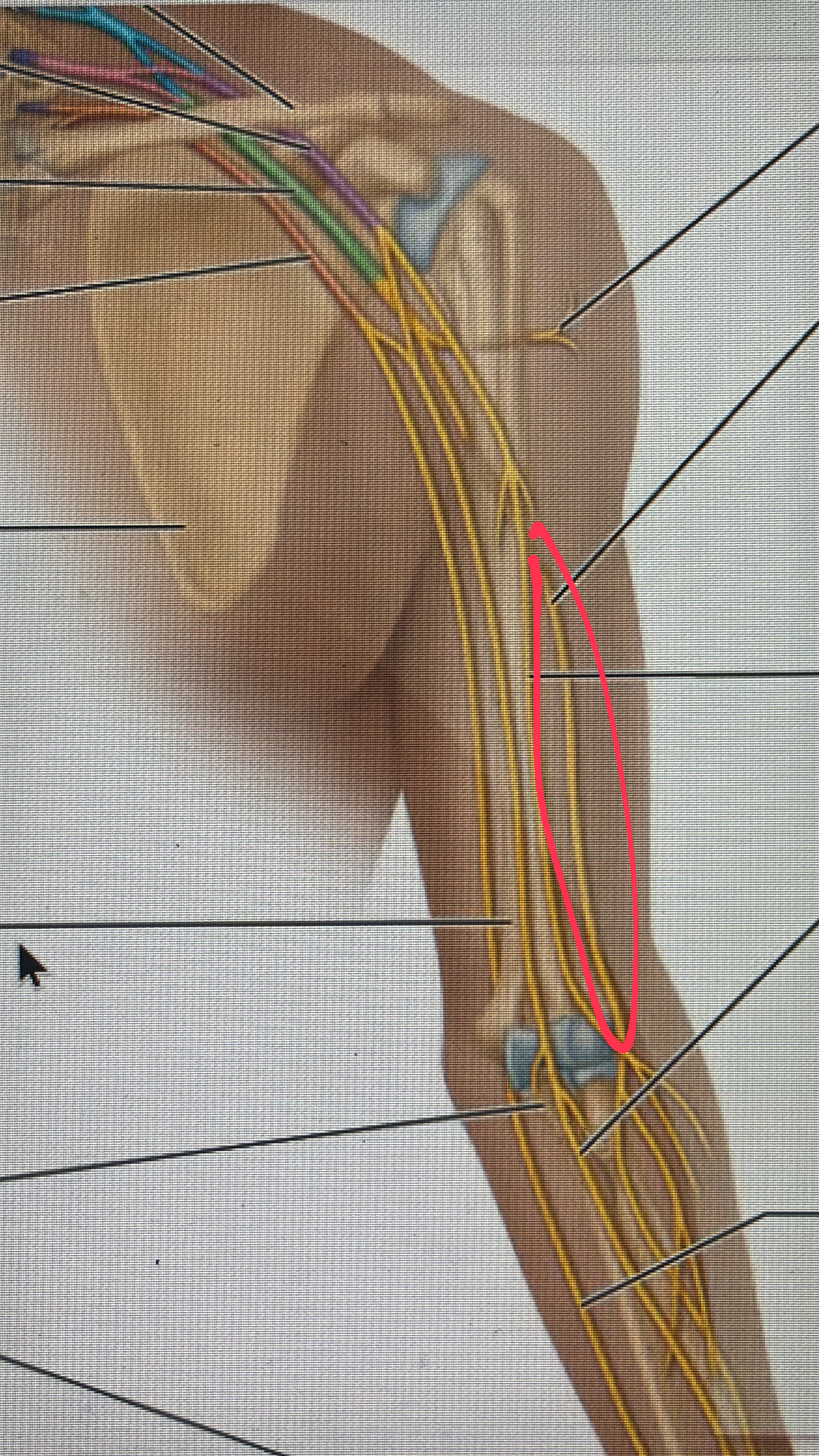 <p>motor to the triceps brachii, brachioradialis, and the extensor muscle</p>