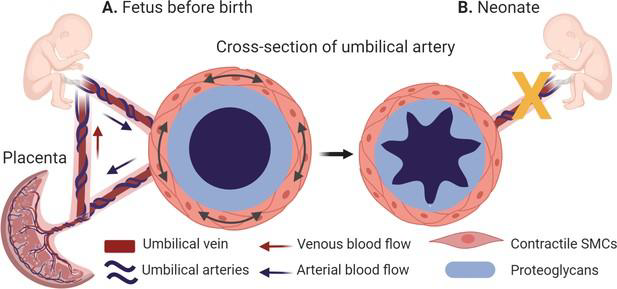<p>what kind of atrophy?</p>