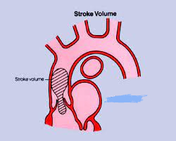 <p>Formula for Stroke?</p>