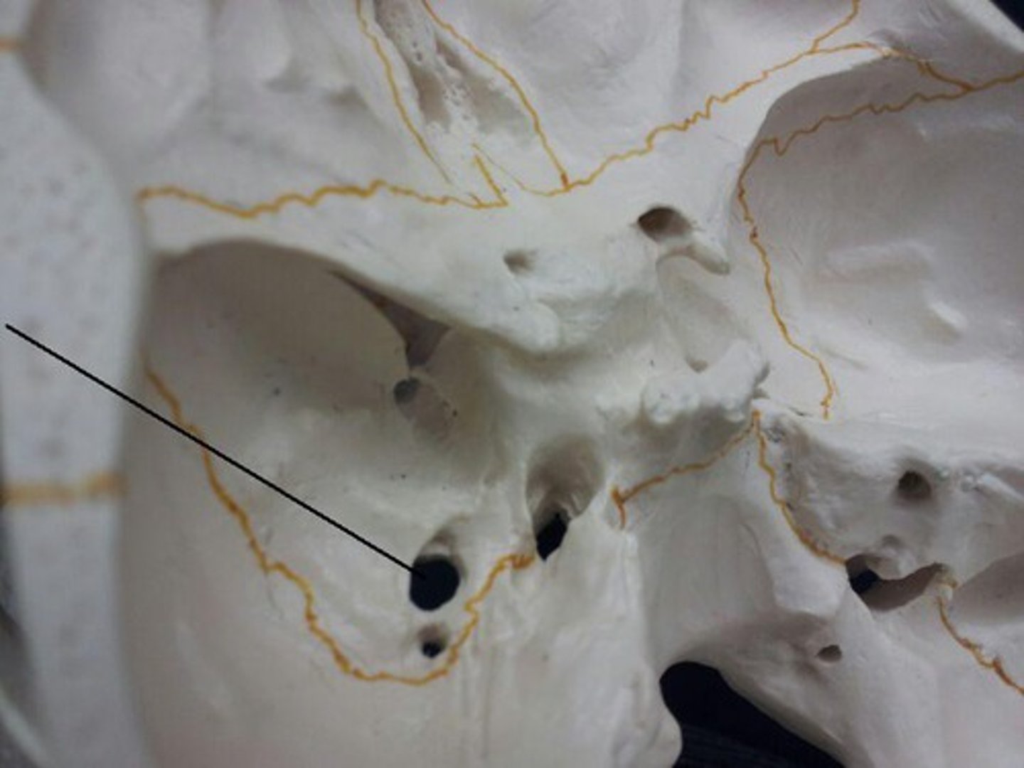 <p>posterior to foramen rotundum; it sits between the media lacerate foramen and lateral foramen spinosum.</p>