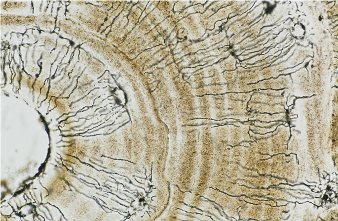 <p>Irradiaciones conlíquido extracelular que conecta las lagunas entre si</p>