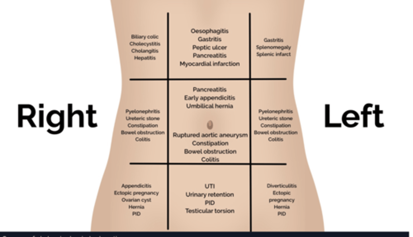 <p>think location (picture)</p><p>systems review:</p><p>- dysphagia</p><p>- vomiting, diarrhoea</p><p>- swollen abdomen</p><p>- blood in stool</p><p>- fever, night sweats, weight loss</p><p>drug history quite important</p><p>ask about diet</p>