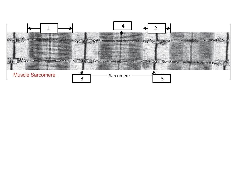 <p><span style="background-color: transparent;">Based on this image identify #3 (at bottom of image)</span></p>