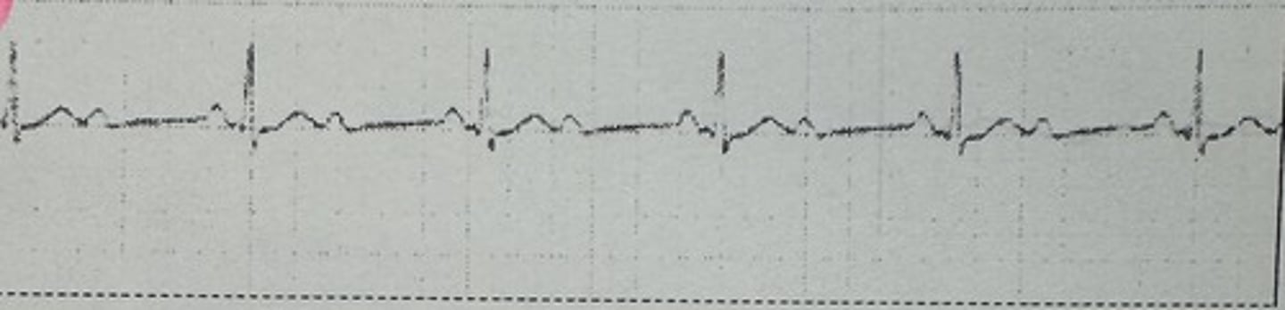 <p>identify the rhythm</p>