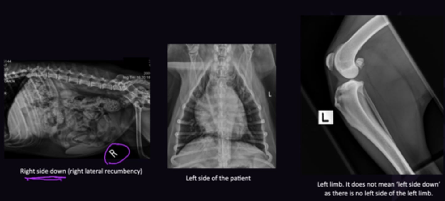 <p>1. Right side down</p><p>2. Left side of patient</p><p>3. Left limb (Does NOT mean left side down)</p>