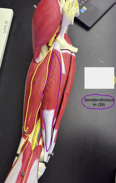 <p>Semitendinosus muscle</p>