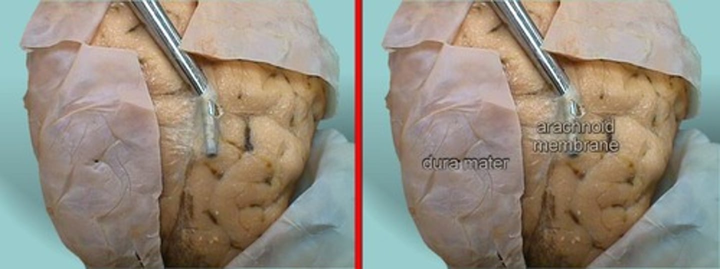 <p>- Just deep to the dura mater</p><p>- Thin and delicate</p><p>- Encloses the subarachnoid spaces</p><p>- continuous with the subarachnoid space around the brain</p>