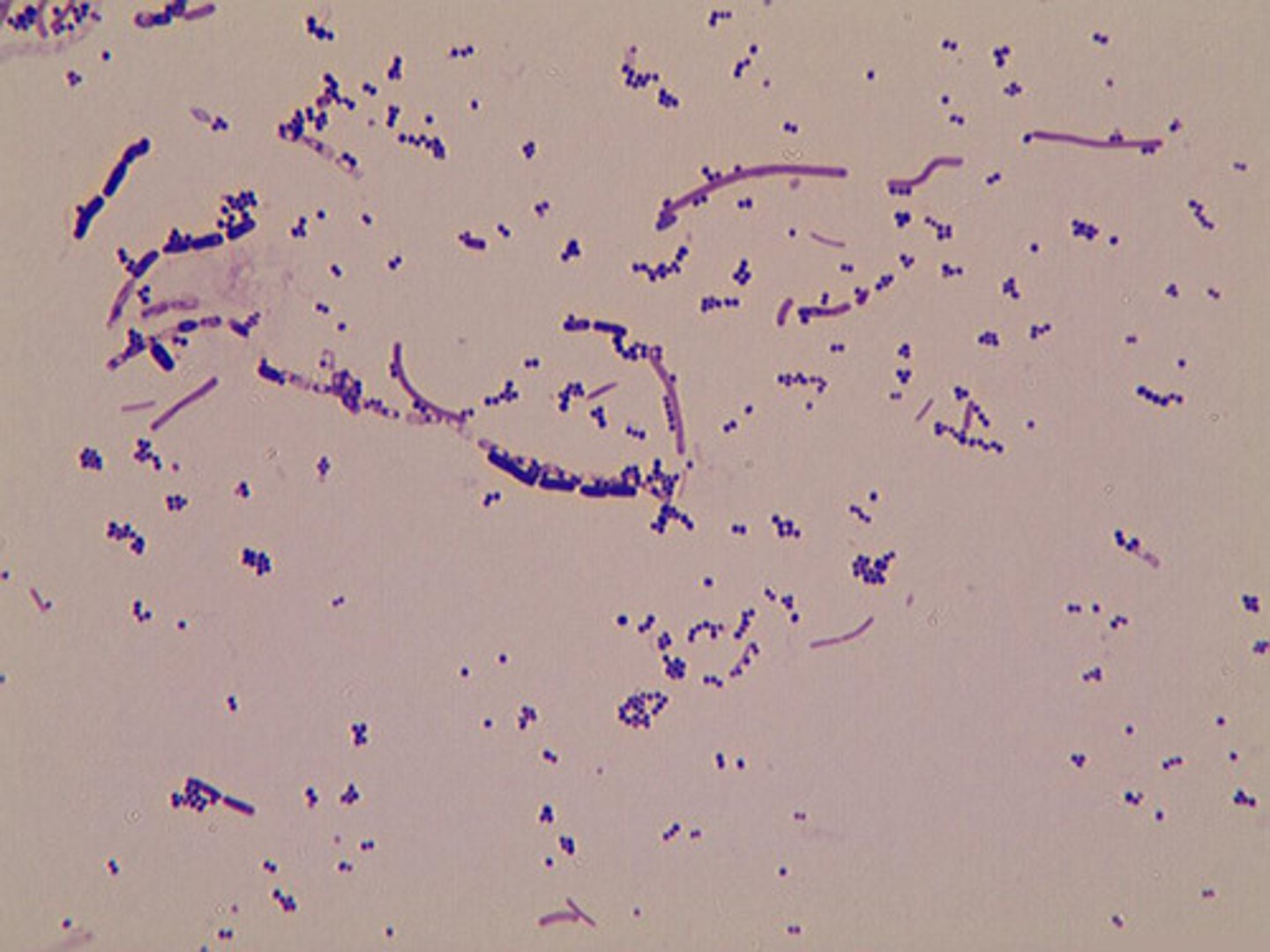 <p>which bacterium can have mixed gram reaction?</p>