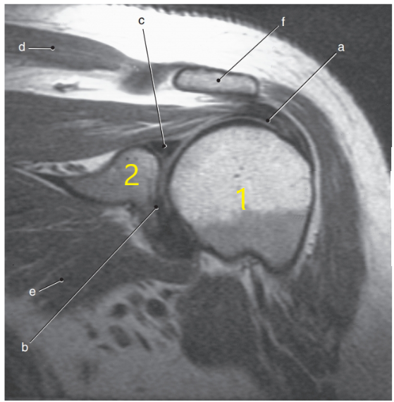<p>What anatomy is # 1 ?</p>