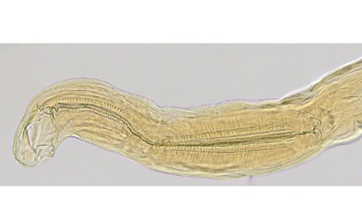 <p>Hookworm with chitinous cutting plates that infects the SI of canids & felids </p><p>-more likely to be found in cooler regions of the US</p>