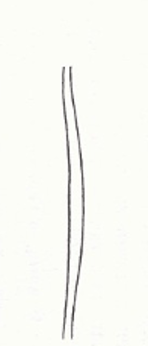 <p>Welke graad reflux wordt beschreven: enkel contrast in ureter</p>