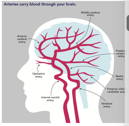 <ul><li><p>Amount of brain tissue affected by occlusion of an artery depends on the location of the occlusion in the artery. </p></li><li><p>Occlusions in the trunk or main branch of the cerebral artery affect large regions of the brain. </p></li><li><p>Occlusions in peripheral branches affect smaller regions.</p></li></ul><p></p>