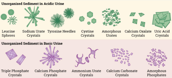 <p><span>crystalline in nature, and forms when dissolved chemicals precipitate out of the solution. These are common in urine when someone is dehydrated and will change depending on the pH of the urine</span></p>