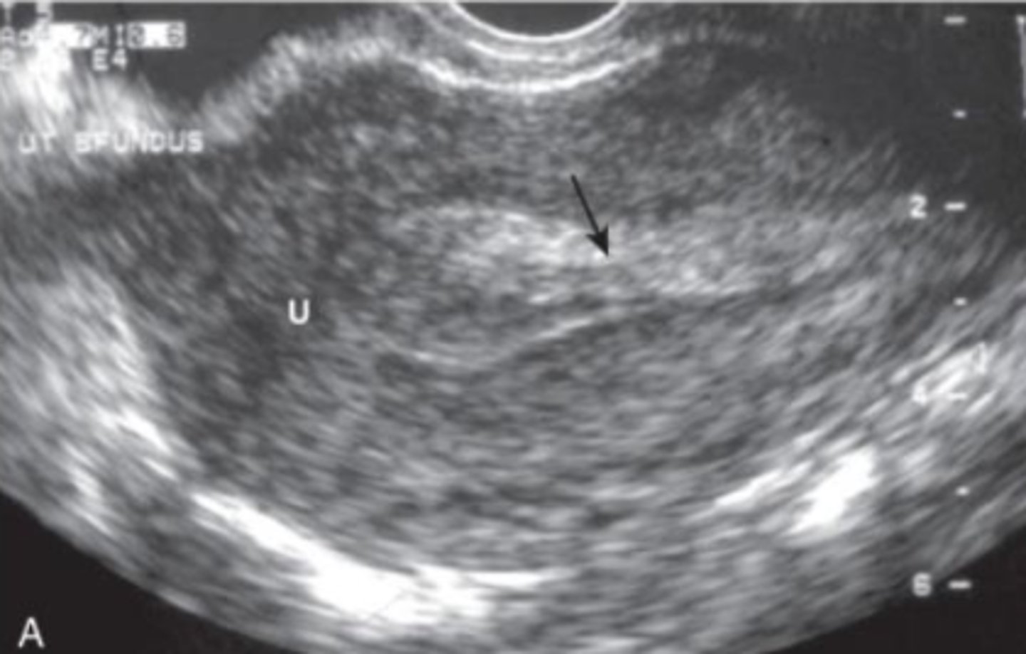<p>patient with positive pregnancy test</p>