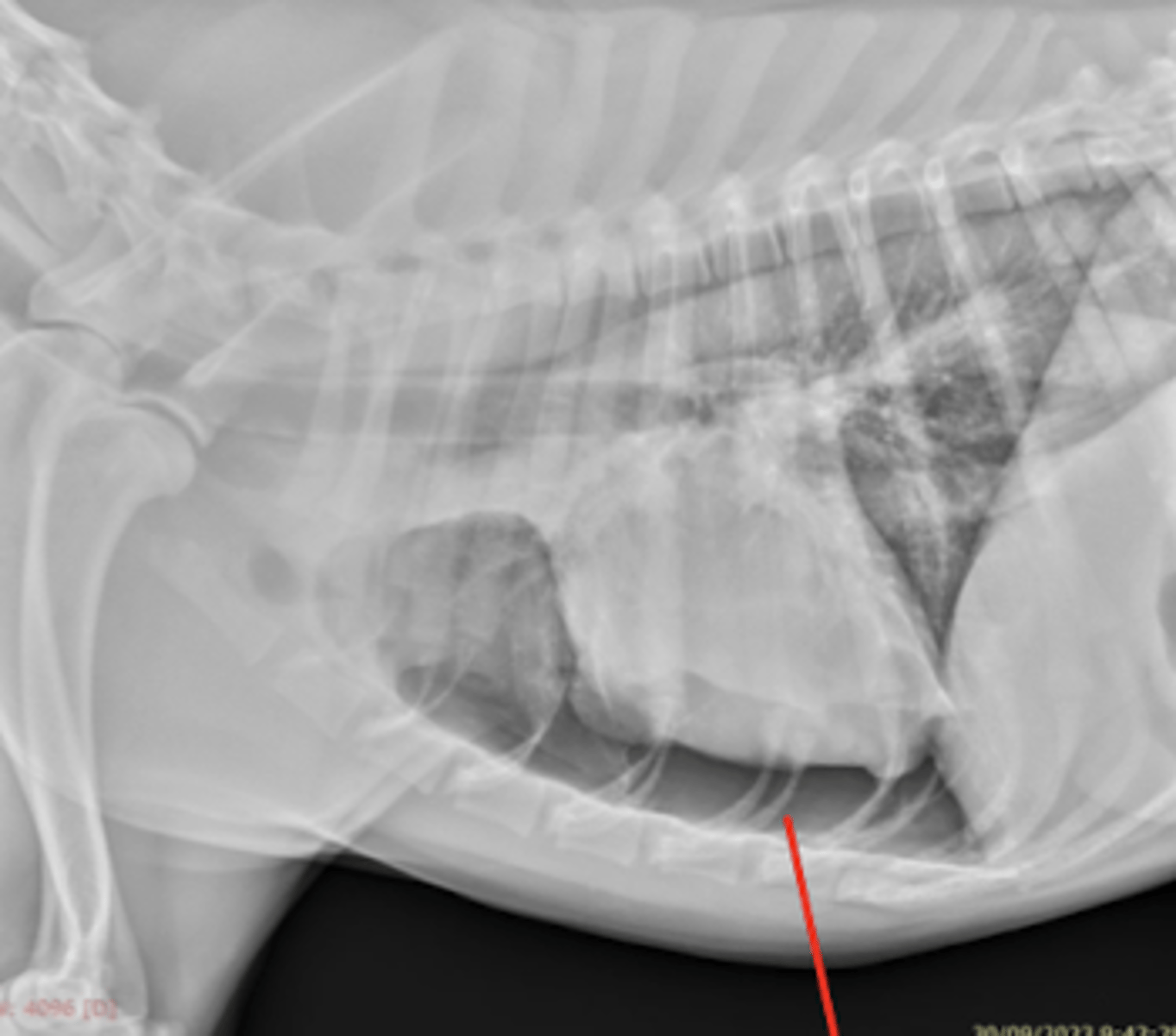 <p>hueco anecoíco entre el corazón y la pared torácica.</p>