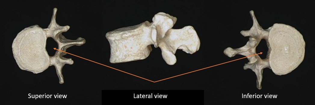 vertebral foramen 