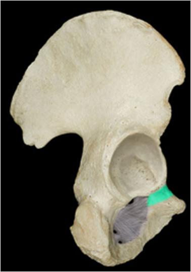 <p>continuation of the inferior ramus of the obturator foramen</p>