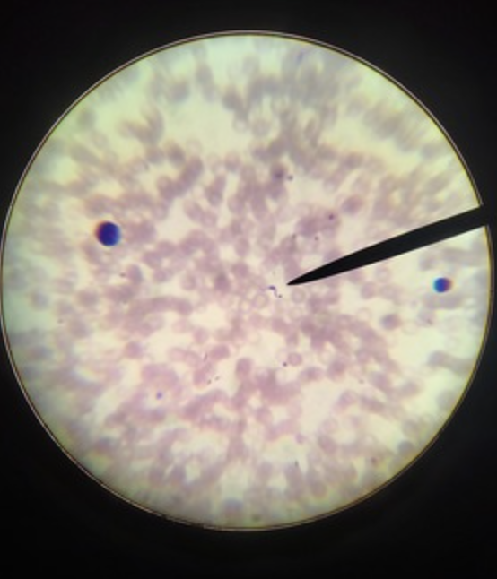 <ul><li><p>identify _ c</p></li><li><p>m.o.t</p></li><li><p>infective stage</p></li><li><p>d host, i host</p></li><li><p><u>disease</u></p></li></ul><p></p>