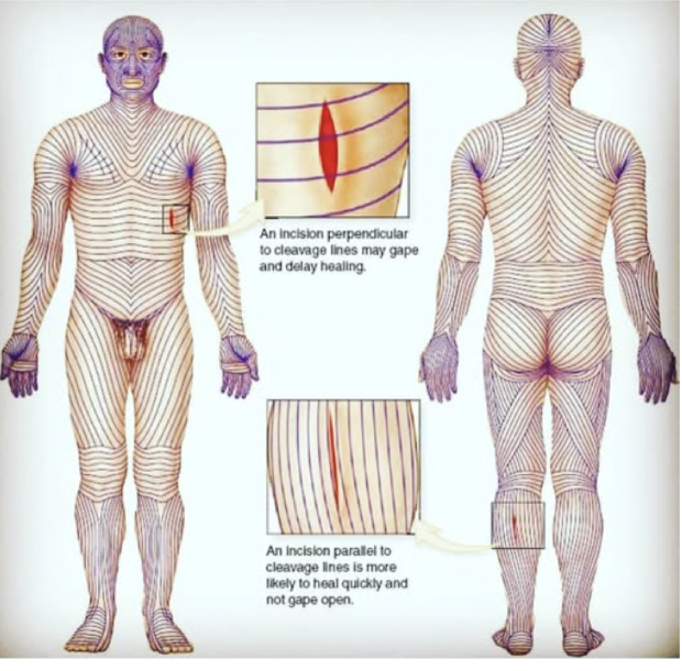 <p>cleavage lines, are topological lines drawn on a map of the human body <strong>parallel to the natural orientation of collagen fibers in the dermis</strong></p><p>-generally perpendicular to underlying muscle fibers, prevents gaping, allows for better cosmesis </p>