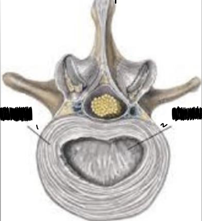 <p>identify</p><p>nucleaus pulposus</p><p>annulus fibrosis</p>