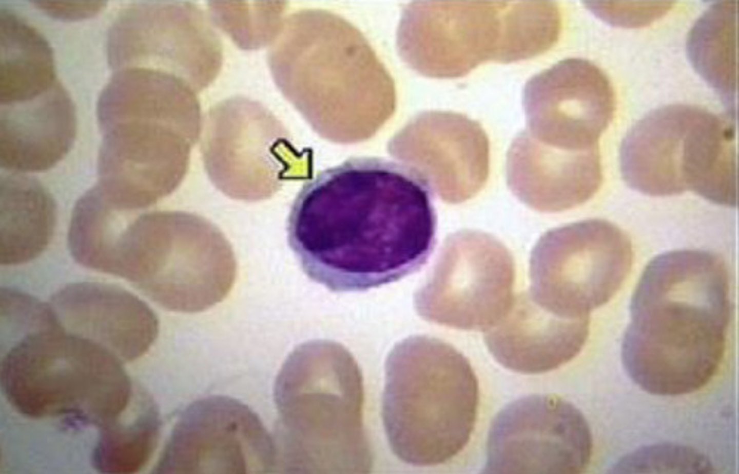 <p>What type of WBC is seen in this image?</p>