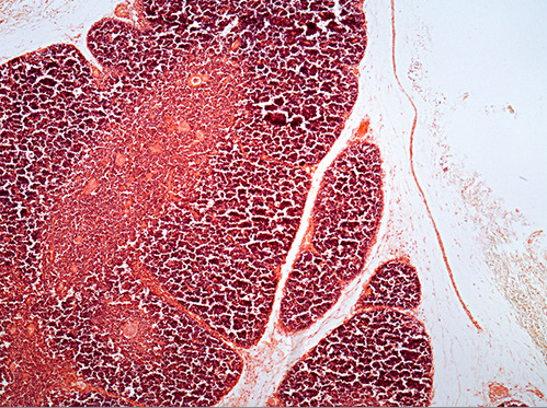 <p><span>This is low power image of what organ? <strong>thymus</strong></span></p>