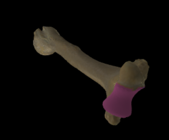 <p>Meest mediale articulatievlak voor de ulna, diabolovormig.</p>