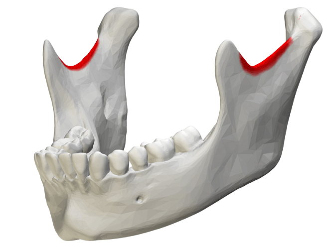 <p>What bone structure is the highlighted area?</p>