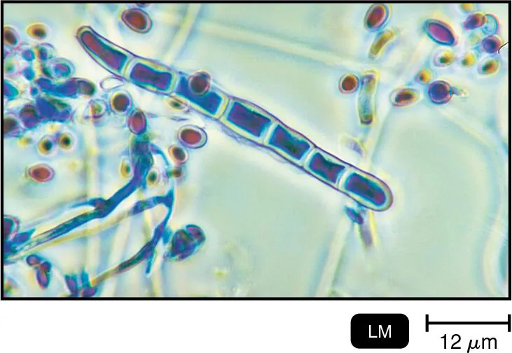 <p><strong>NAME IT</strong> Identify the structures of this eukaryote, which has an affinity for keratin.</p>