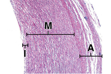 <p>includes endothelium, basal lamina and in arteries an internal elastic membrane, indicated by I</p>