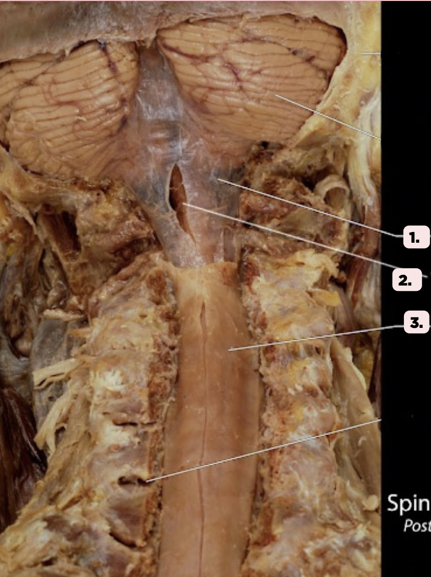 <p>Identify the structure labeled as 1.</p>