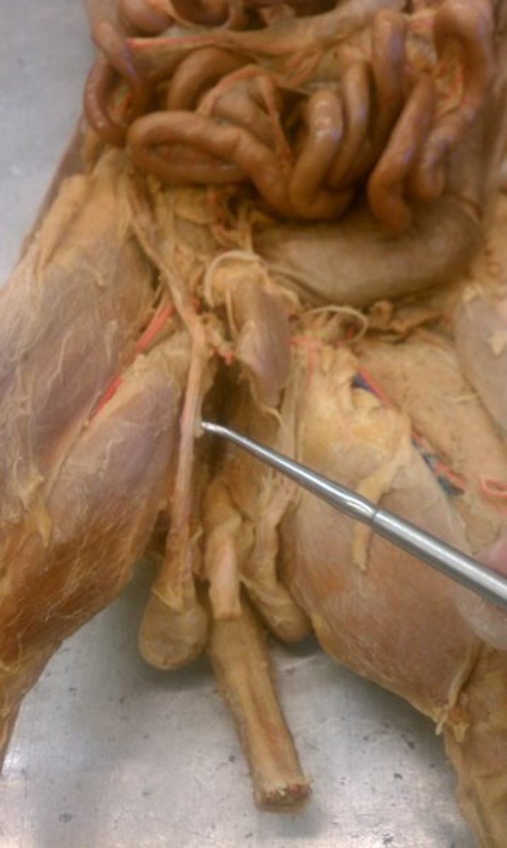 <p>Spermatic cord</p>