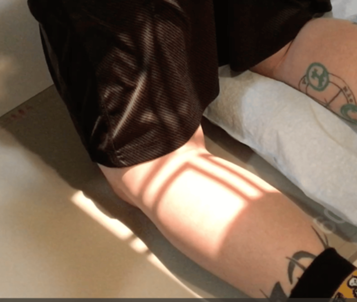 <p>Pt Placement: Prone and then up on hands and knees so femur forms a 20 degree angle with CR</p><p>Collimation: part size</p><p>CR Placement: middle of knee joint</p><p>Tube tilt: none</p><p>SID: 40" tabletop</p><p>Breathing: DBDM</p><p>Shield: drape over their back</p>