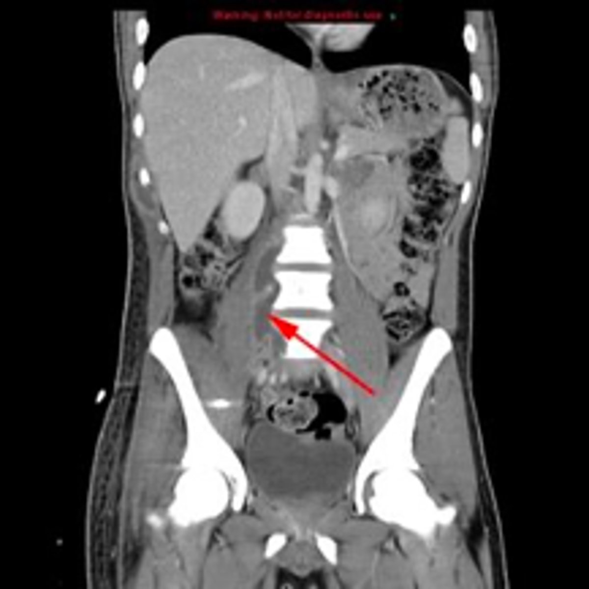 <p><em>identify the pathology</em> </p>