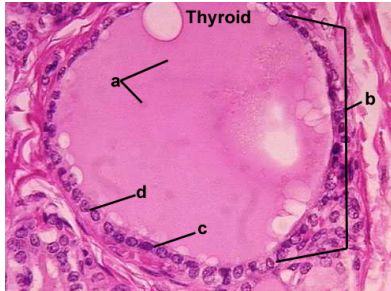 <p>a. Identify substance</p><p>b. Identify entire structure</p><p>c. Identify epithelium</p><p>d. What epithelium does answer "c" look like when answer for "b" is empty?</p>