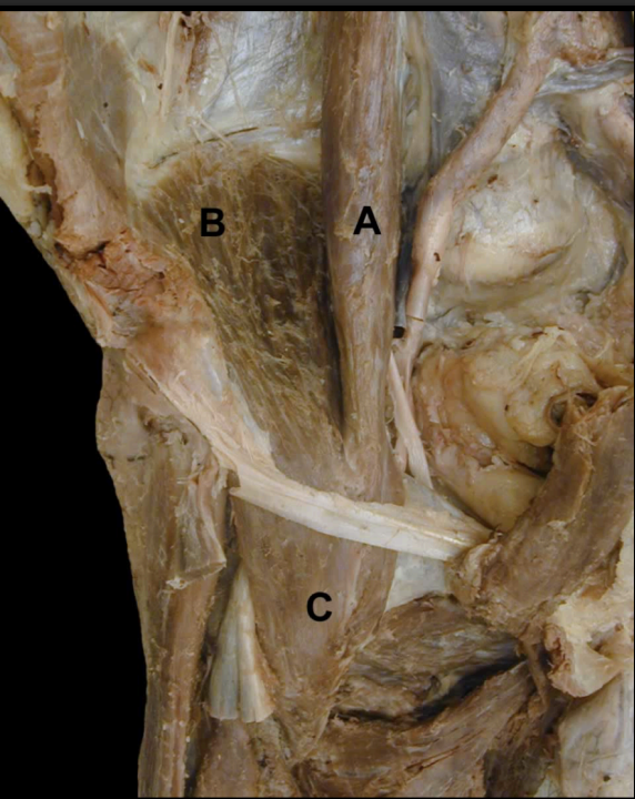 <p>Identify the indicated muscles that make up the Iliopsoas Muscle </p>