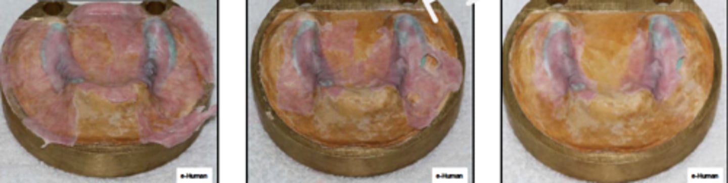 <p>ID the phase:</p>