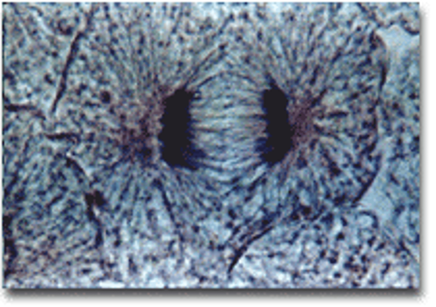 <p>the third phase of mitosis, during which the chromosome pairs separate and move toward opposite poles</p>