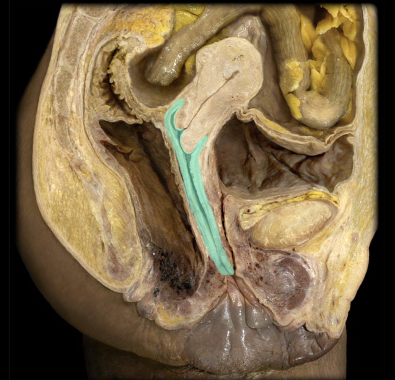<p>What structure is shown?</p>