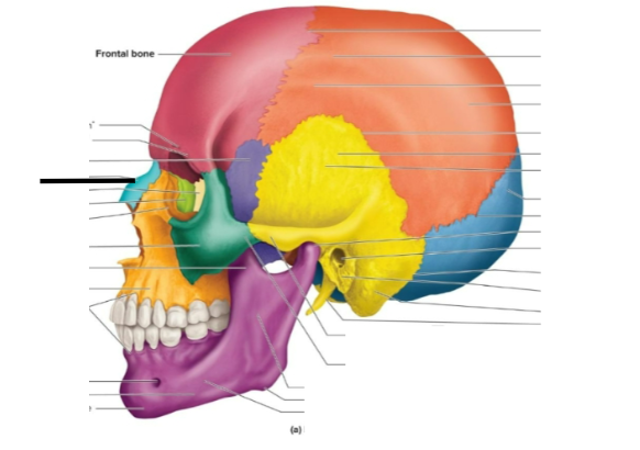 term image