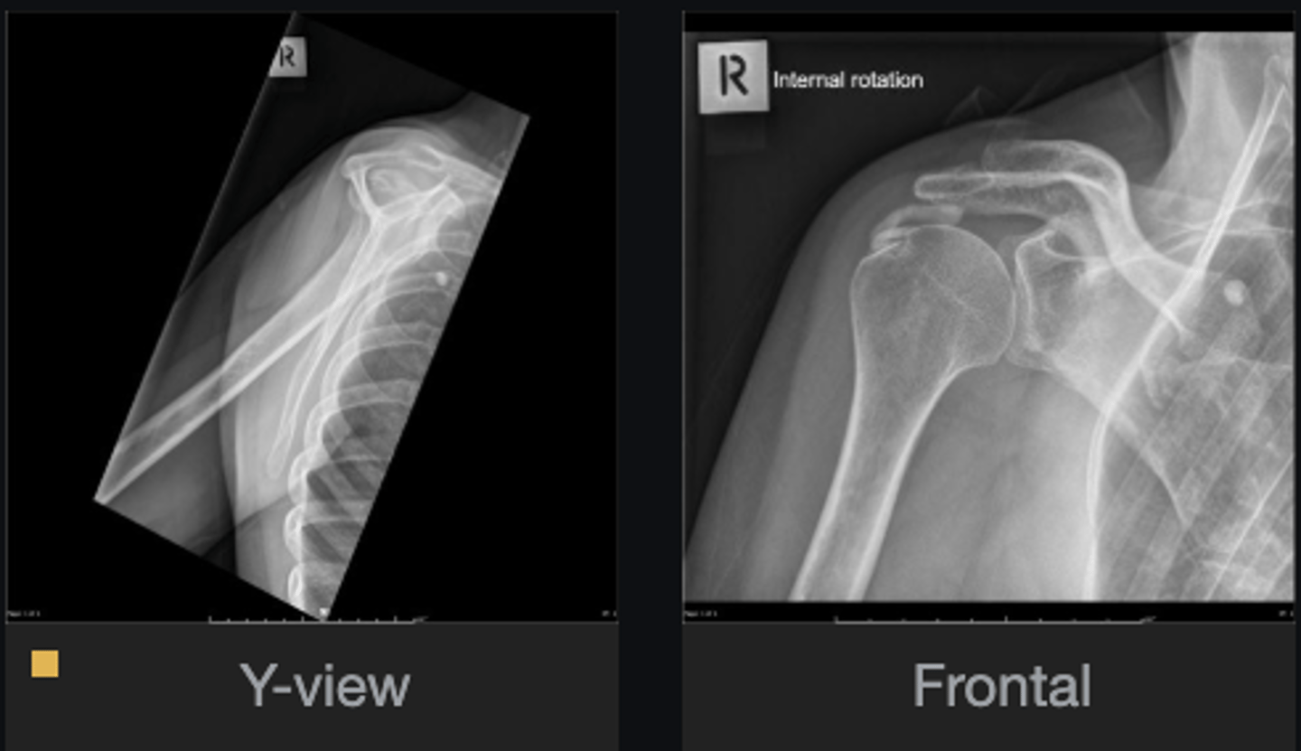 <p>Do you see anything else that is abnormal?</p>