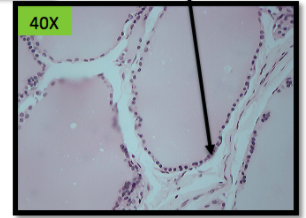 * straight nucleus side by side 
* Thyroid, salivary gland, ducts

\
