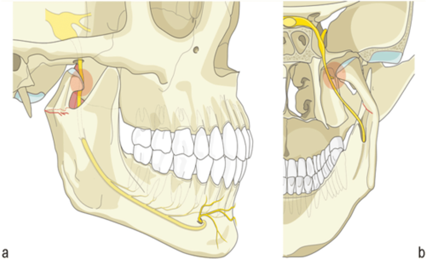 <p>Inferior alveolar nerve</p>