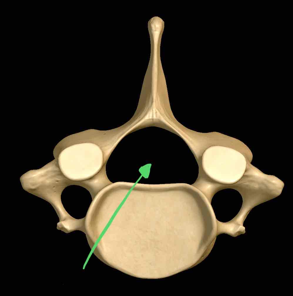 <p>Name this structure </p>