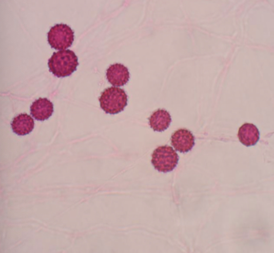 <p>Sepedonium spp.</p>