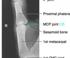 <p><span>-Evidence of proper collimation and side markers laterally<br>-distal tip to trapezium<br>-proper rotation: concave surface demonstrated by concave surface of elevated side of the proximal phalanx and metacarpal<br>-Bony trabecular detail and surrounding tissue</span></p>