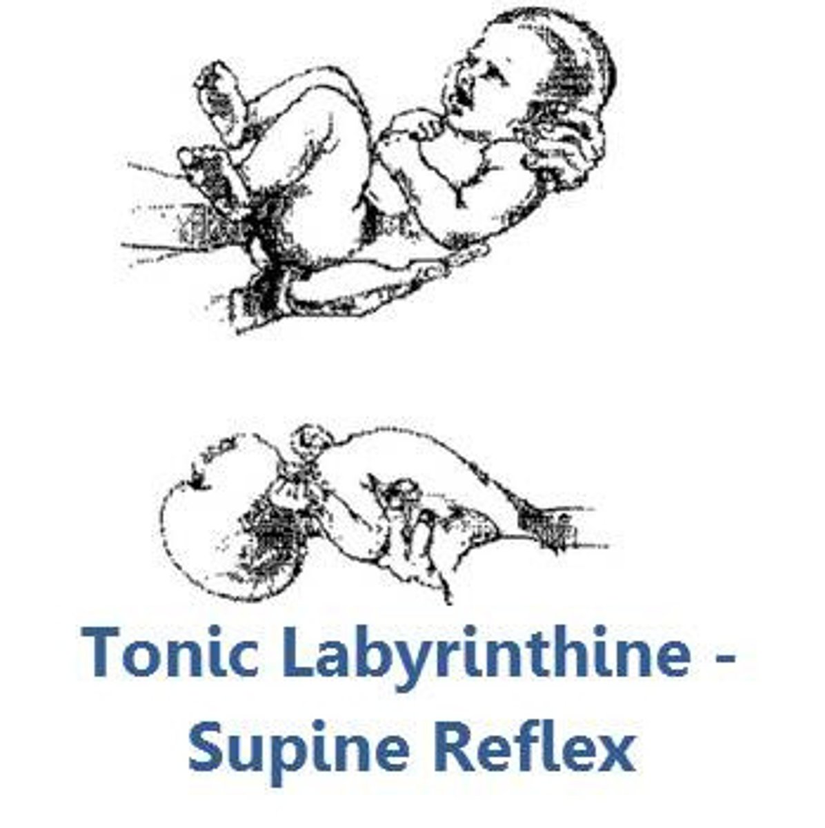 <p>Stim: prone or supine position</p><p>Response:</p><p>-Prone: increased flexor tone</p><p>-Supine: increased extensor tone</p><p>Onset: Birth</p><p>Integrated: 6 mo</p><p>May be impossible to be sidelying due to extensor tone limits flexion of shoulder and hip on one side needed for rolling</p>